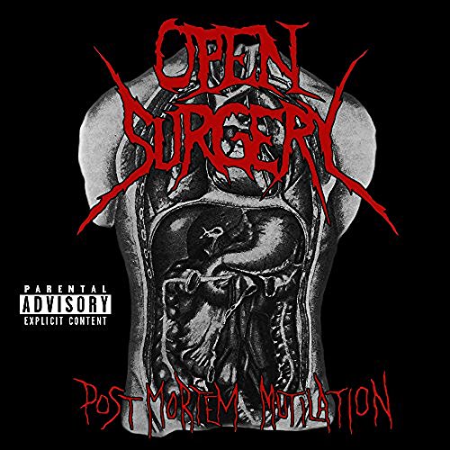 Open Surgery - Post Mortem Mutilation (2016)